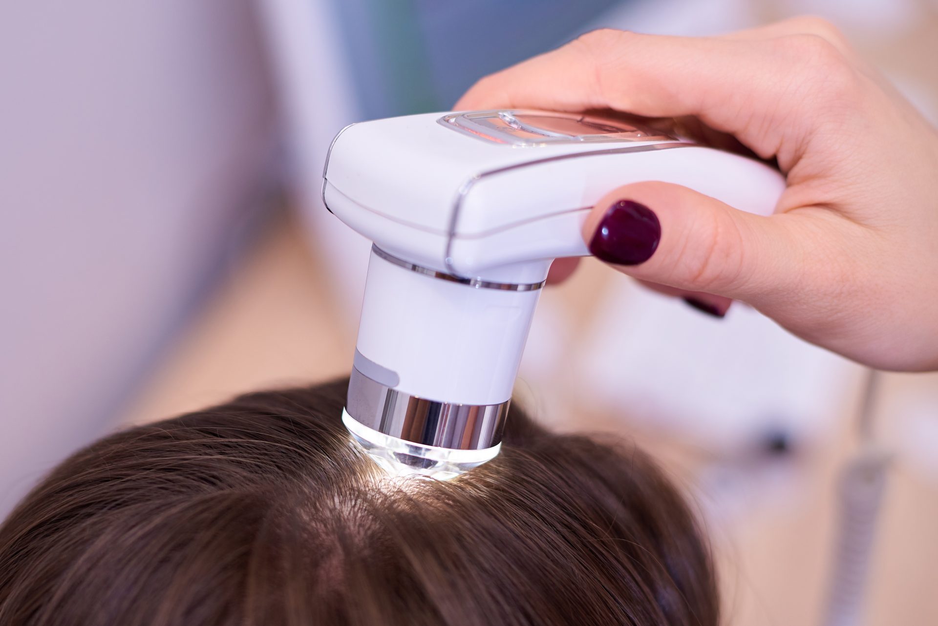 analisi cuoio capelluto capelli fragili caduta capelli uomini donne cause rimedi